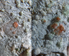 Varicellaria hemisphaerica