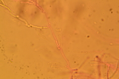 Gloeomucro dependens