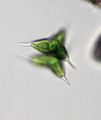 Staurodesmus megacanthus