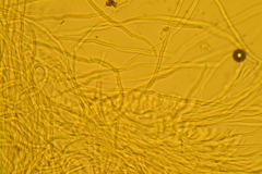 Rectipilus confertus