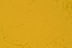 Rectipilus confertus