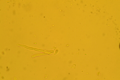 Rectipilus confertus