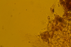 Atrobrunnea