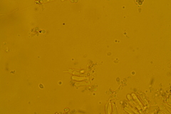 Atrobrunnea