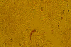 Atrobrunnea