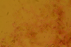 Atrobrunnea