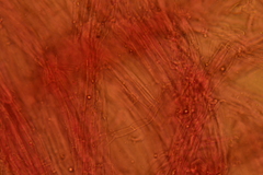 Atrobrunnea