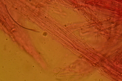 Atrobrunnea