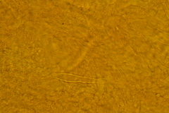 Pseudohydropus