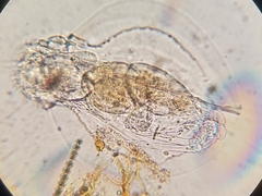 Rotifera