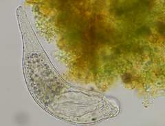 Platyhelminthes