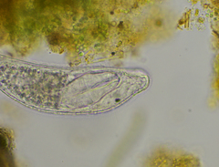 Platyhelminthes