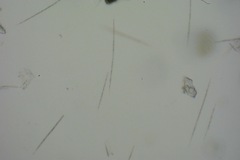 Bacteria
