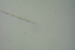 Bacteria
