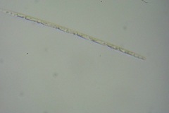 Bacteria
