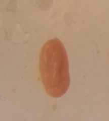 Miliammina obliqua
