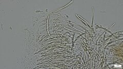 Hypomyces subiculosus