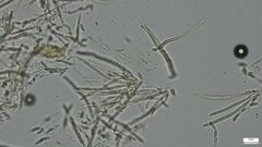 Hypomyces subiculosus