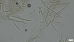 Hypomyces subiculosus