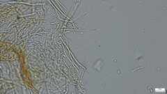 Hypomyces subiculosus