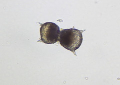 Protozoa