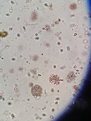 Lamprocystis