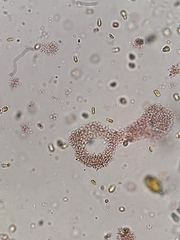 Lamprocystis
