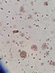 Lamprocystis