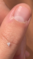 Prociphilus tessellatus