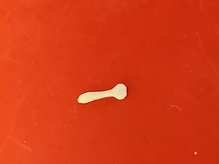 Cestoda