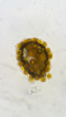 Puccinia coronata