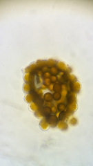 Puccinia coronata