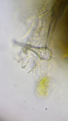 Puccinia coronata