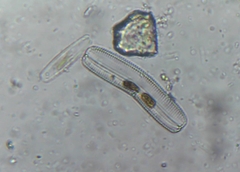 Bacillariophyceae
