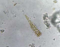 Bacillariophyceae
