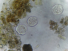 Sessilida