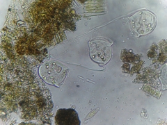 Sessilida