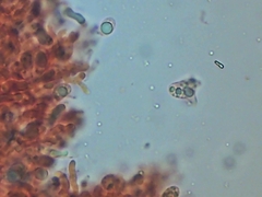 Sebacina schweinitzii