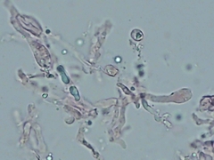 Sebacina schweinitzii