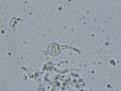 Sebacina schweinitzii