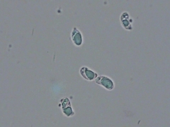 Sebacina schweinitzii