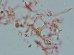 Sebacina schweinitzii