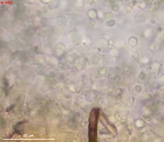 Leptosporomyces