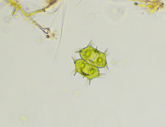 Xanthidium antilopaeum polymazum