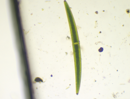 Closterium turgidum