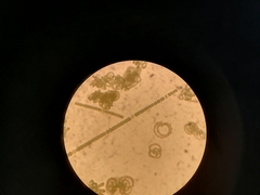 Cyanobacteria