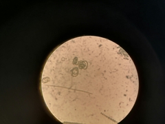 Dolichospermum