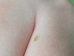 Aphidomorpha