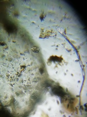 Sessilida