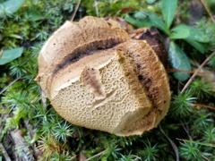 Scleroderma